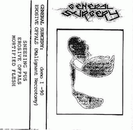 General Surgery : Erosive Offals (Malignant Necrotomy)